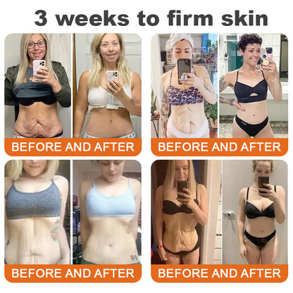 In Deutschland hergestellt und versendet ✨ ODALIT™ Bienengift-Komplexcreme 🔥 LETZTER TAG: 80 % RABATT