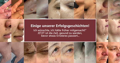 ODALIT®KeraErase Dual-Action Erneuerungscreme