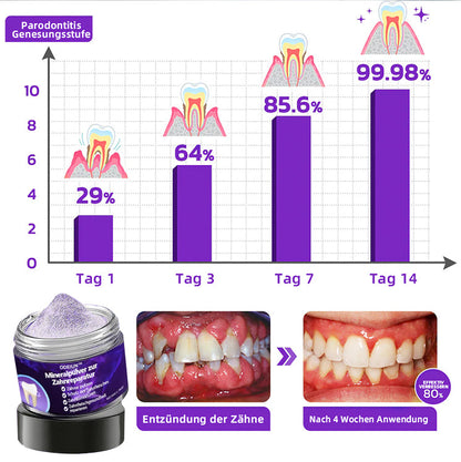 Blitzangebot 😍 – Nicht verpassen! – ODEIUN™ Mineralpulver zur Zahnreparatur 🦷 (von der BZÄK empfohlen) 👩‍⚕️ (Hilft bei Parodontitis und Mundgeschwüren, schützt vor Zahnverlust und unterstützt die Regeneration von zurückgehendem Zahnfleisch)