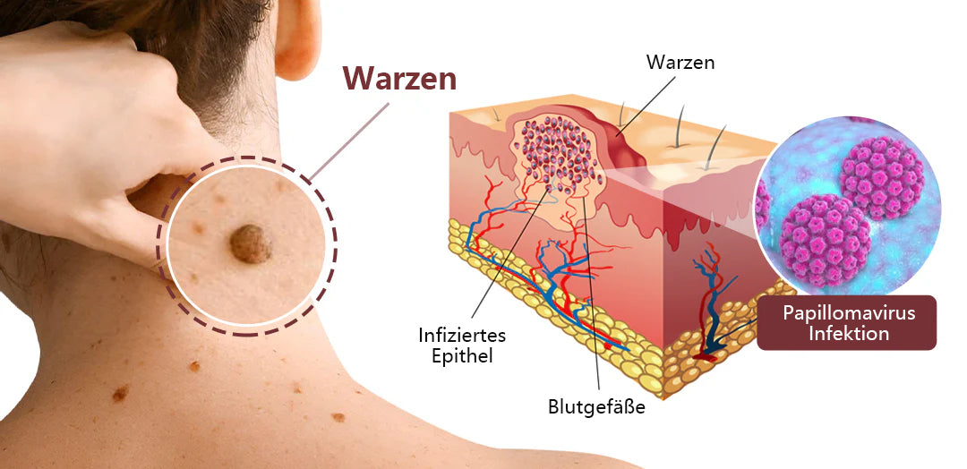 ODALIT®KeraErase Dual-Action Erneuerungscreme