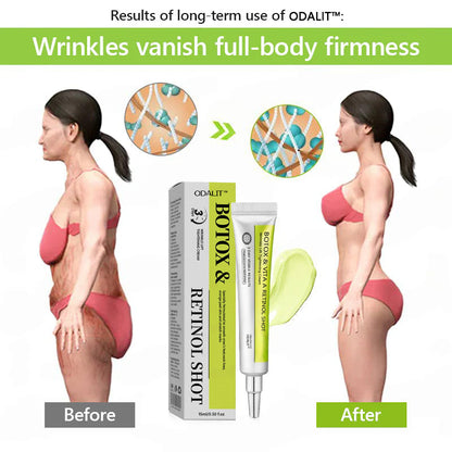 🎁 Letzter Aktionstag – Nicht verpassen – ODALIT™ Botox & Vita-A Retinol Shot ✨👁️ 👩‍⚕️ Dermatologisch geprüfte Formel für einen kraftvollen Lifting-Effekt und sichtbar reduzierte Schwellungen