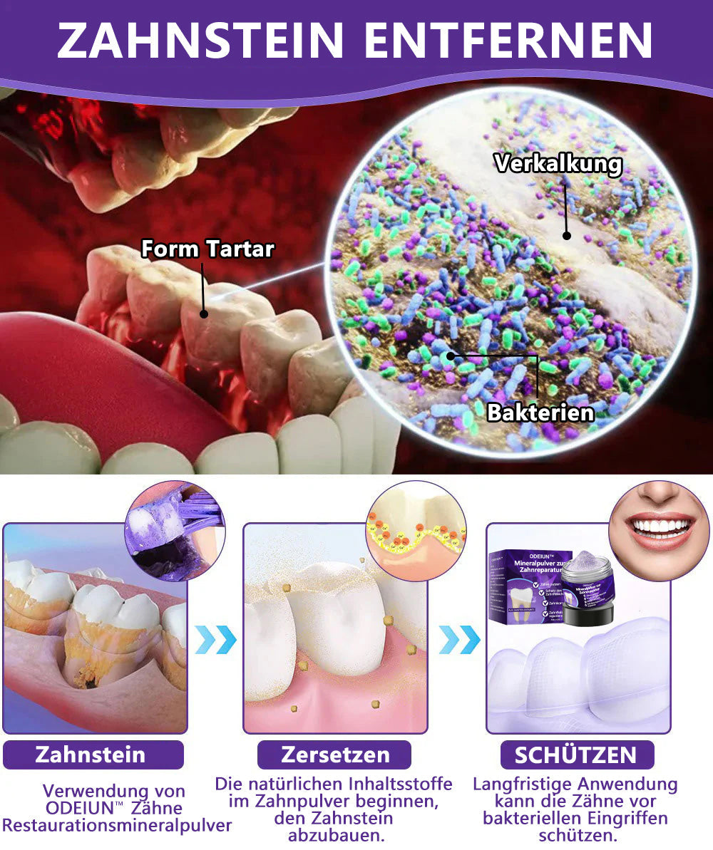 Blitzangebot 😍 – Nicht verpassen! – ODEIUN™ Mineralpulver zur Zahnreparatur 🦷 (von der BZÄK empfohlen) 👩‍⚕️ (Hilft bei Parodontitis und Mundgeschwüren, schützt vor Zahnverlust und unterstützt die Regeneration von zurückgehendem Zahnfleisch)