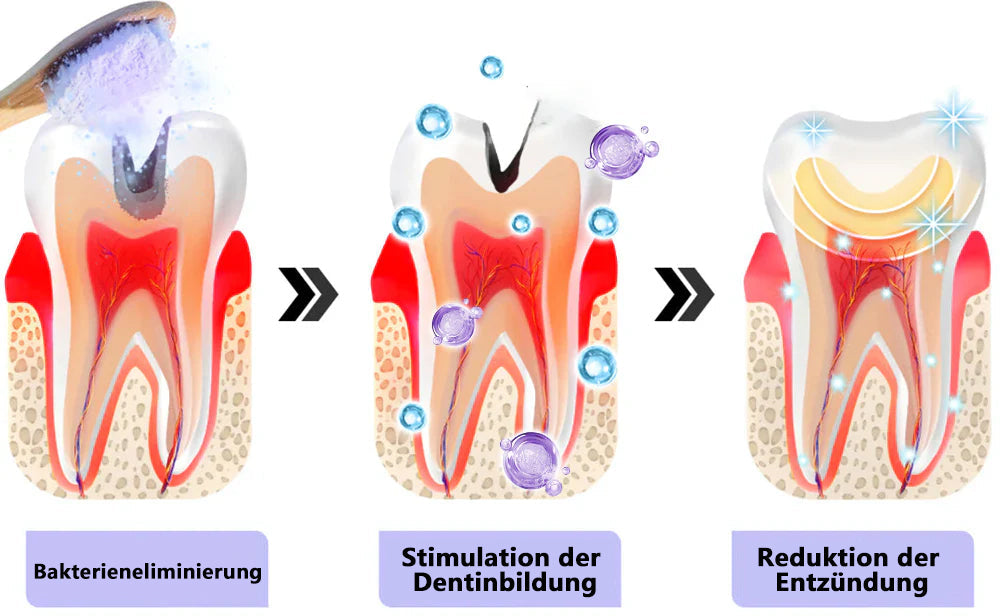 Blitzangebot 😍 – Nicht verpassen! – ODEIUN™ Mineralpulver zur Zahnreparatur 🦷 (von der BZÄK empfohlen) 👩‍⚕️ (Hilft bei Parodontitis und Mundgeschwüren, schützt vor Zahnverlust und unterstützt die Regeneration von zurückgehendem Zahnfleisch)