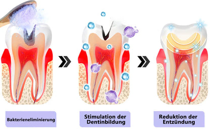 Blitzangebot 😍 – Nicht verpassen! – ODEIUN™ Mineralpulver zur Zahnreparatur 🦷 (von der BZÄK empfohlen) 👩‍⚕️ (Hilft bei Parodontitis und Mundgeschwüren, schützt vor Zahnverlust und unterstützt die Regeneration von zurückgehendem Zahnfleisch)