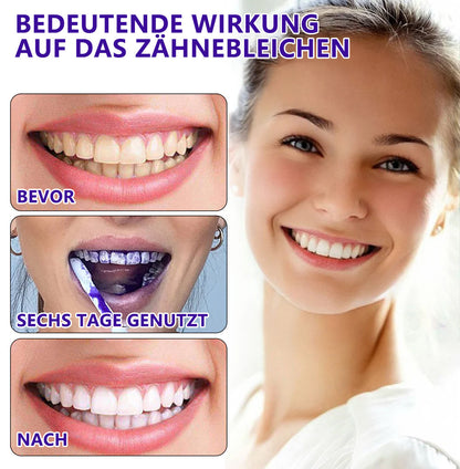 Blitzangebot 😍 – Nicht verpassen! – ODEIUN™ Mineralpulver zur Zahnreparatur 🦷 (von der BZÄK empfohlen) 👩‍⚕️ (Hilft bei Parodontitis und Mundgeschwüren, schützt vor Zahnverlust und unterstützt die Regeneration von zurückgehendem Zahnfleisch)