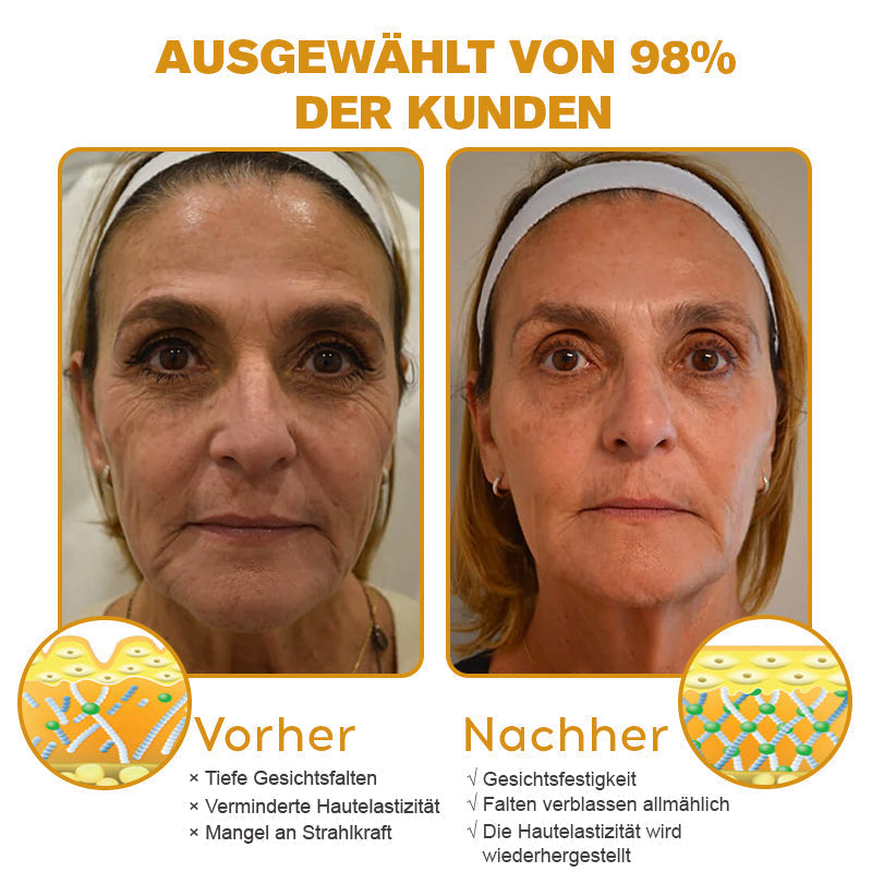 👨‍⚕️ Hergestellt in Deutschland - ✨ODALIT® Botox Bienenvenom Faltenentfernungscreme