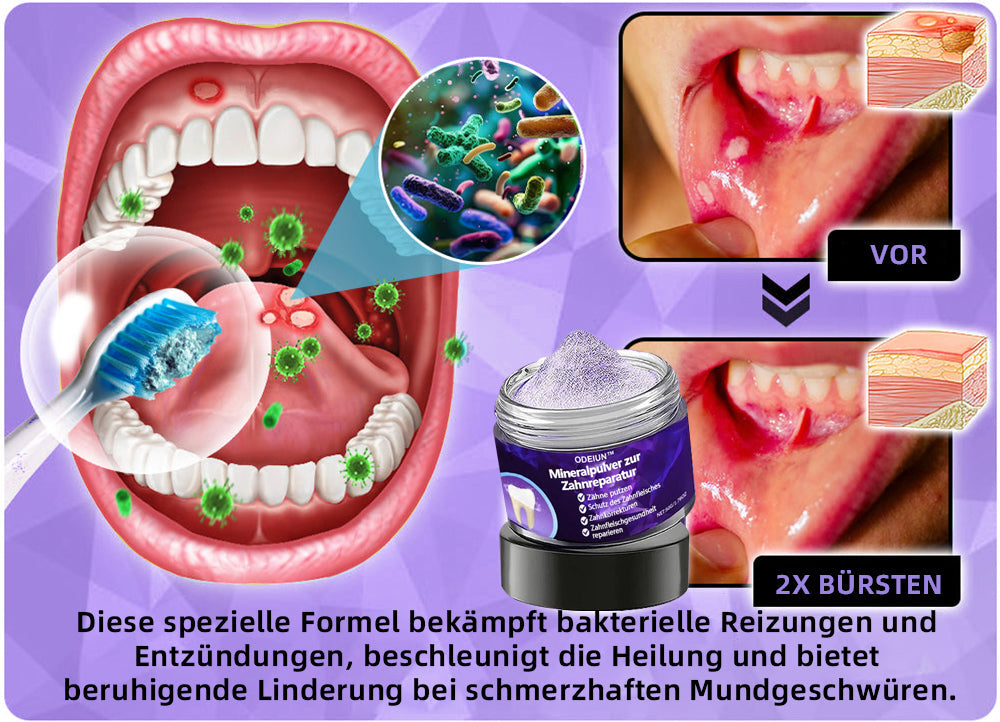 Blitzangebot 😍 – Nicht verpassen! – ODEIUN™ Mineralpulver zur Zahnreparatur 🦷 (von der BZÄK empfohlen) 👩‍⚕️ (Hilft bei Parodontitis und Mundgeschwüren, schützt vor Zahnverlust und unterstützt die Regeneration von zurückgehendem Zahnfleisch)