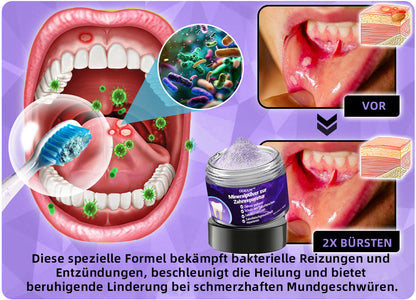 Blitzangebot 😍 – Nicht verpassen! – ODEIUN™ Mineralpulver zur Zahnreparatur 🦷 (von der BZÄK empfohlen) 👩‍⚕️ (Hilft bei Parodontitis und Mundgeschwüren, schützt vor Zahnverlust und unterstützt die Regeneration von zurückgehendem Zahnfleisch)