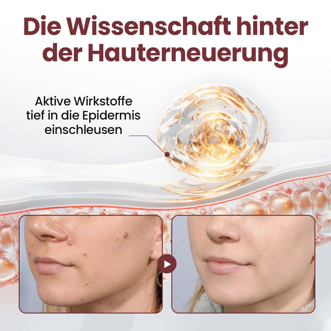 Neue Produkte 2026: FDA- und EHI-Zertifizierungen ODALIT®  KeraErase Dual-Action Erneuerungscreme