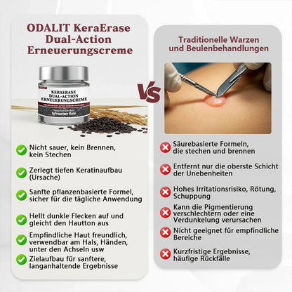 ODALIT®KeraErase Dual-Action Erneuerungscreme