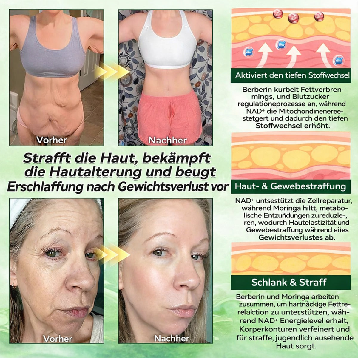 𝗢𝗳𝗳𝗶𝘇𝗶𝗲𝗹𝗹𝗲𝗿 𝗦𝗵𝗼𝗽 | 📌 LBMLBM® 𝗠𝗼𝗿𝗶𝗻𝗴𝗮 𝗕𝗲𝗿𝗯𝗲𝗿𝗶𝗻𝗲𝘅 𝗡𝗔𝗗+ 𝟭𝟬-𝗶𝗻-𝟭 𝗡𝗮𝗻𝗼-𝗠𝗶𝗸𝗿𝗼𝗻𝗮𝗱𝗲𝗹-𝗣𝗮𝘁𝗰𝗵 (𝗡𝘂𝗿 𝗲𝗶𝗻𝗺𝗮𝗹 𝘁ä𝗴𝗹𝗶𝗰𝗵, 𝘀𝗶𝗰𝗵𝘁𝗯𝗮𝗿𝗲 𝗩𝗲𝗿ä𝗻𝗱𝗲𝗿𝘂𝗻𝗴𝗲𝗻 𝗶𝗻 𝟳 𝗧𝗮𝗴𝗲𝗻) ✅ 𝗙ü𝗿 Ü𝗯𝗲𝗿𝗴𝗲𝘄𝗶𝗰𝗵𝘁, 𝗹𝗼𝗰𝗸𝗲𝗿𝗲 𝗛𝗮𝘂𝘁, 𝗗𝗶𝗮𝗯𝗲𝘁𝗲𝘀, 𝗦𝗰𝗵𝗹𝗮𝗳𝗮𝗽𝗻𝗼𝗲, 𝗚𝗲𝗹𝗲𝗻𝗸𝗽𝗿𝗼𝗯𝗹𝗲𝗺𝗲 𝘂𝗻𝗱 𝗺𝗲𝗵𝗿