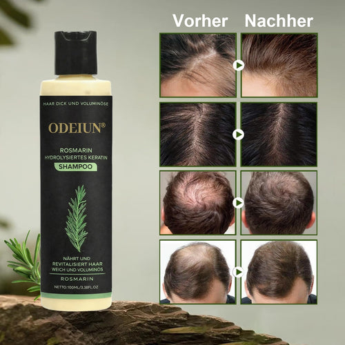 🔥LETZTER TAG – 49 % RABATT🌱 Bio-Rosmarin Shampoo – Unterstützt natürliches Haarwachstum