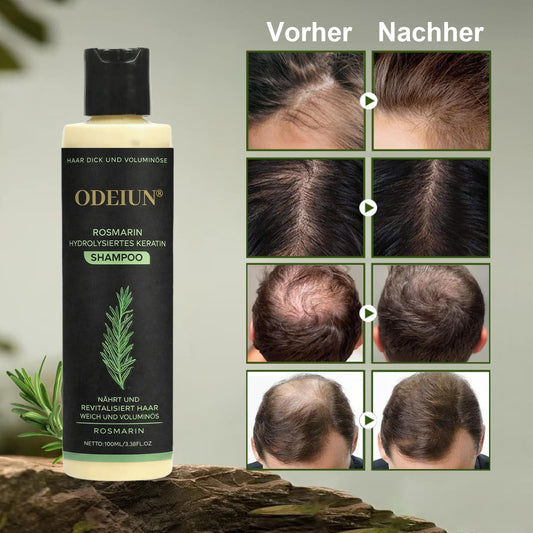 🔥LETZTER TAG – 49 % RABATT🌱 Bio-Rosmarin Shampoo – Unterstützt natürliches Haarwachstum