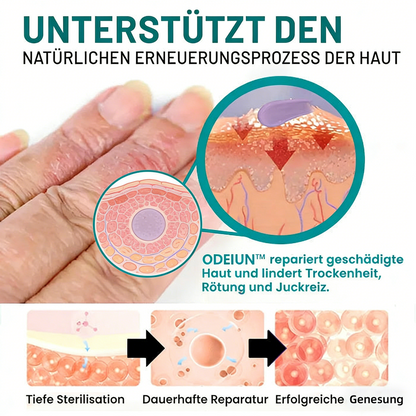 ODEIUN™ Probiotische Feuchtigkeitscreme mit Vitamin B – 24h Pflege bei Ekzemen