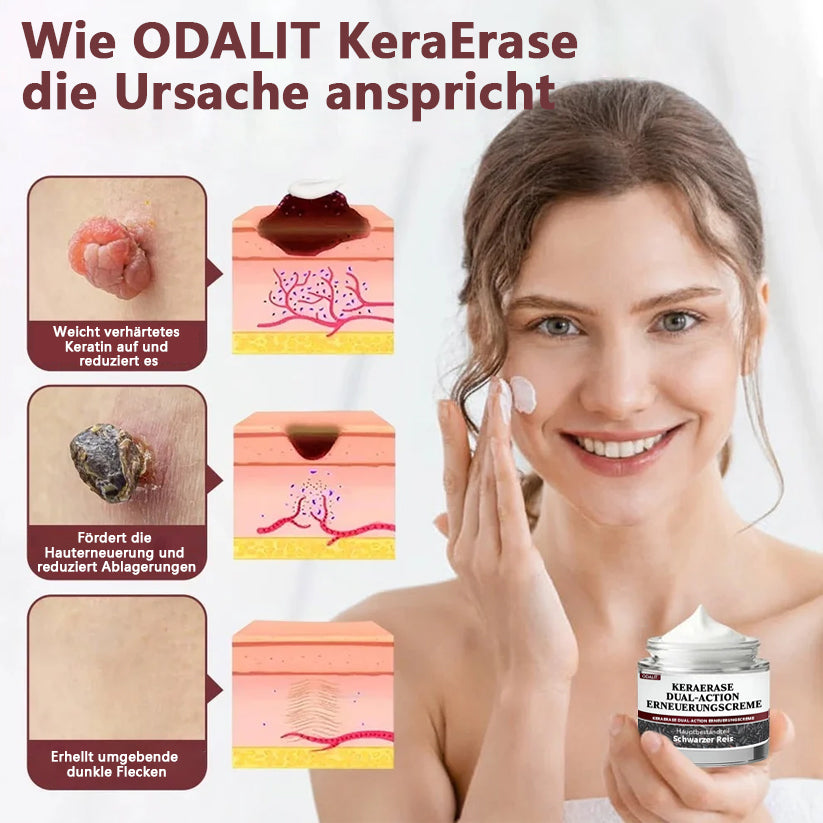 ODALIT®KeraErase Dual-Action Erneuerungscreme