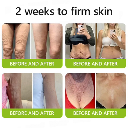 🎁 Letzter Aktionstag – Nicht verpassen – ODALIT™ Botox & Vita-A Retinol Shot ✨👁️ 👩‍⚕️ Dermatologisch geprüfte Formel für einen kraftvollen Lifting-Effekt und sichtbar reduzierte Schwellungen