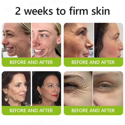 🎁 Letzter Aktionstag – Nicht verpassen – ODALIT™ Botox & Vita-A Retinol Shot ✨👁️ 👩‍⚕️ Dermatologisch geprüfte Formel für einen kraftvollen Lifting-Effekt und sichtbar reduzierte Schwellungen