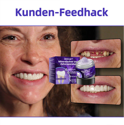 Blitzangebot 😍 – Nicht verpassen! – ODEIUN™ Mineralpulver zur Zahnreparatur 🦷 (von der BZÄK empfohlen) 👩‍⚕️ (Hilft bei Parodontitis und Mundgeschwüren, schützt vor Zahnverlust und unterstützt die Regeneration von zurückgehendem Zahnfleisch)