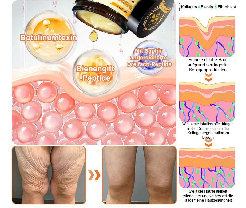In Deutschland hergestellt und versendet ✨ ODALIT™ Bienengift-Komplexcreme 🔥 LETZTER TAG: 80 % RABATT