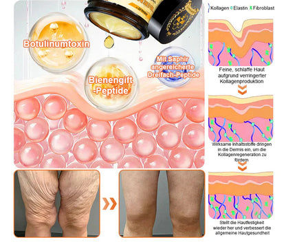 In Deutschland hergestellt und versendet ✨ ODALIT™ Bienengift-Komplexcreme 🔥 LETZTER TAG: 80 % RABATT
