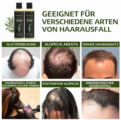 🔥LETZTER TAG – 49 % RABATT🌱 Bio-Rosmarin Shampoo – Unterstützt natürliches Haarwachstum